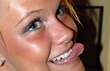 N�ste